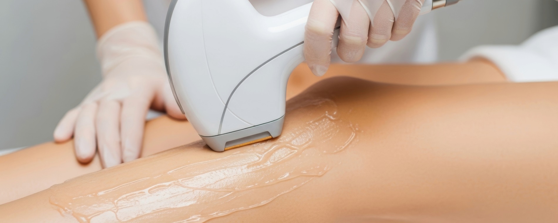 Laser Hair Reduction